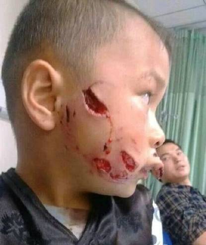 邯郸京珠花园放狗咬人